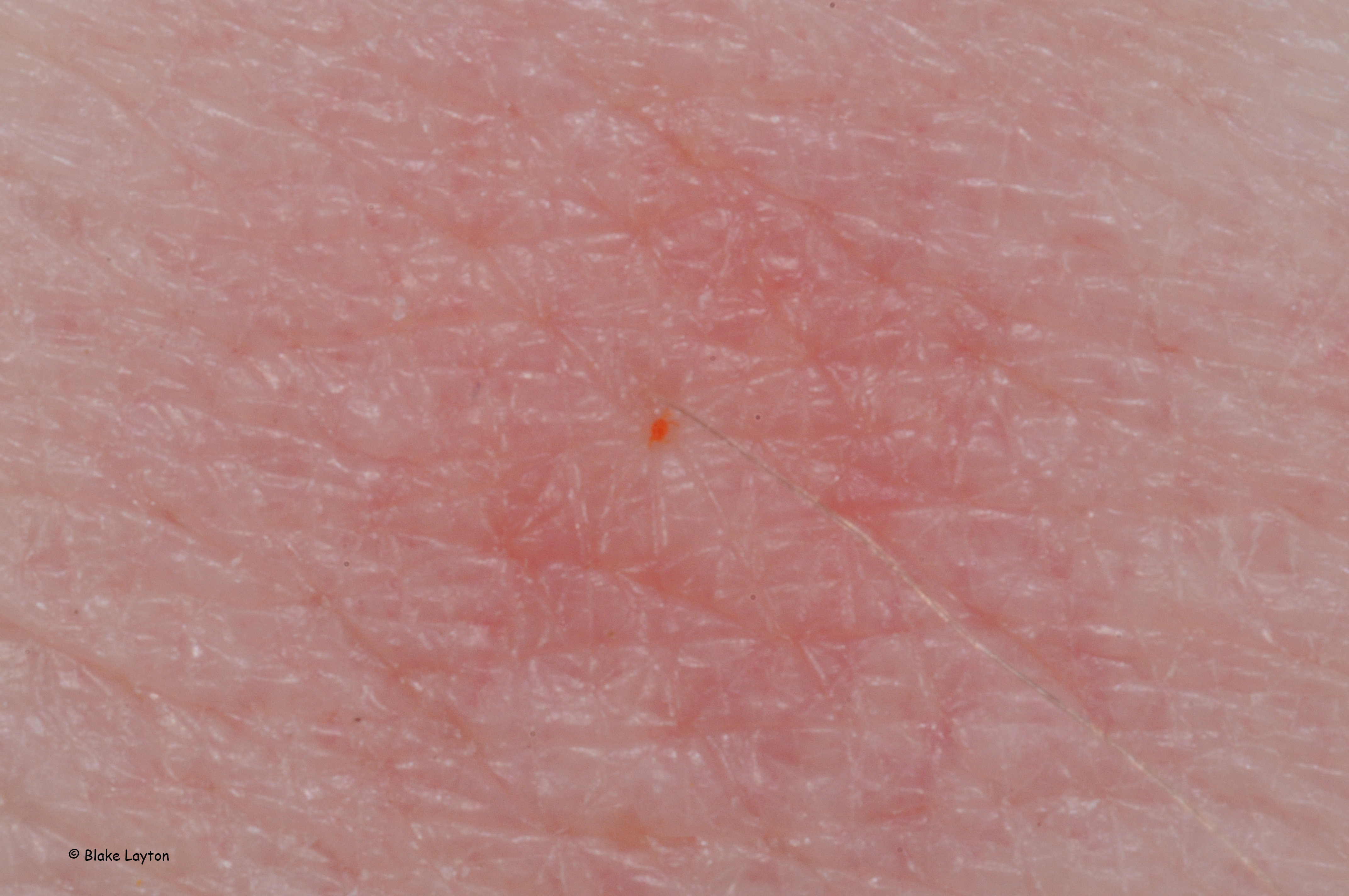 Red dot on skin.