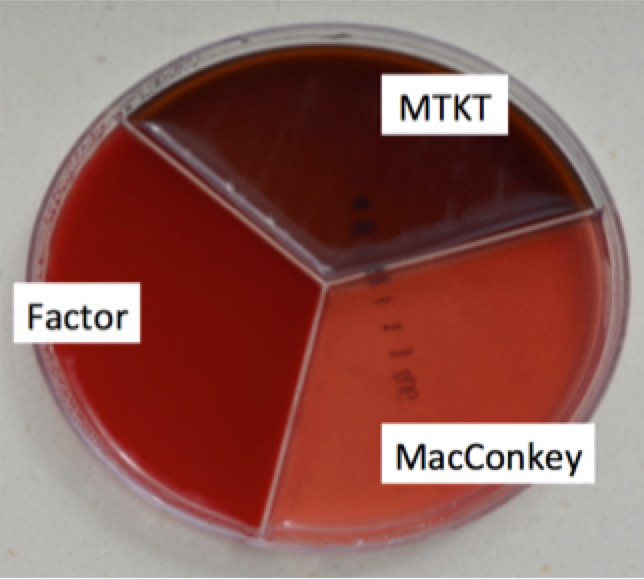 Different agars included in a tri-plate