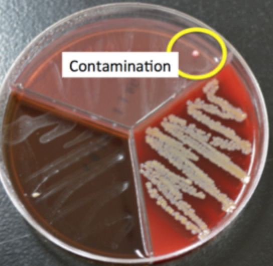 different contamination types and appearances.