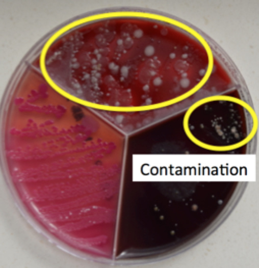 different contamination types and appearances