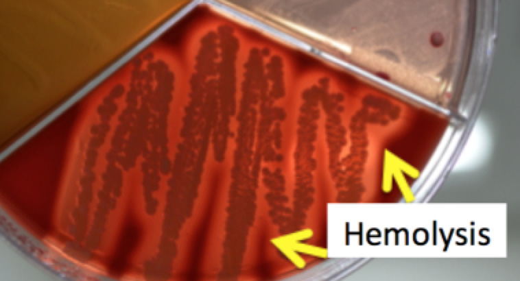 Staphylococcus aureus displaying hemolysis on Factor agar.