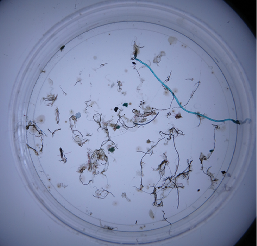 View through a microscope of many small pieces of string-like material and one longer, blue piece.