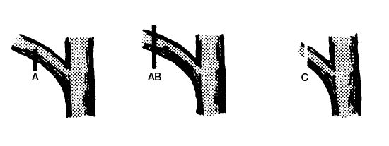 ""