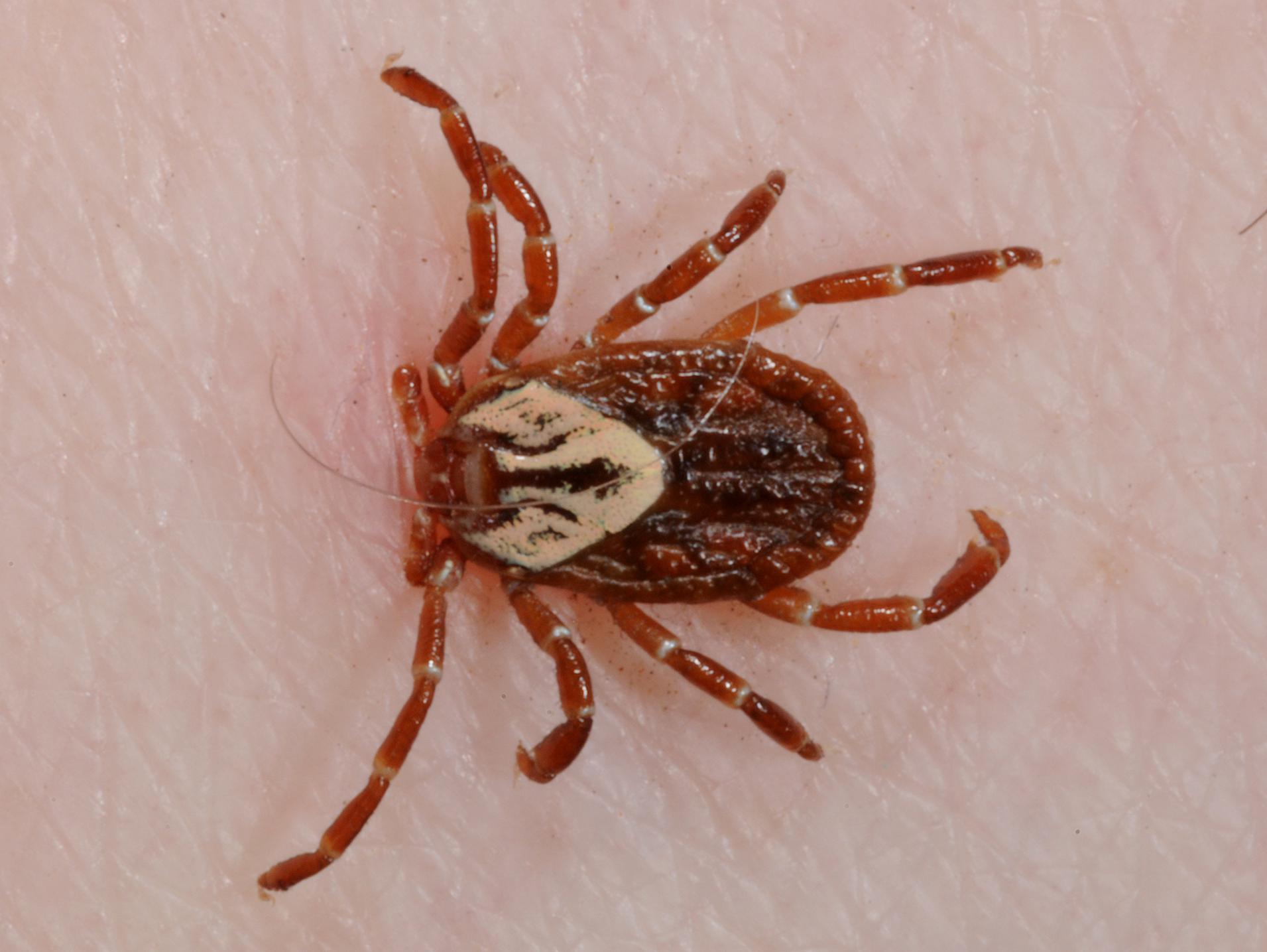 Close-up of a tick attached to human skin.
