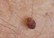 Close-up of a tiny brown insect on human skin.