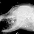 This radiograph shows the approximately 26 pellets in her head and neck.