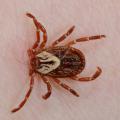 Close-up of a tick attached to human skin.